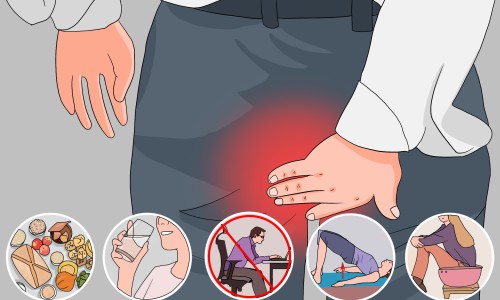 痔疮科医院哪家好-市痔疮治疗价格是多少费用多少钱网痔疮科医院哪家好知识网站,分享医院治疗痔疮要多少钱大全